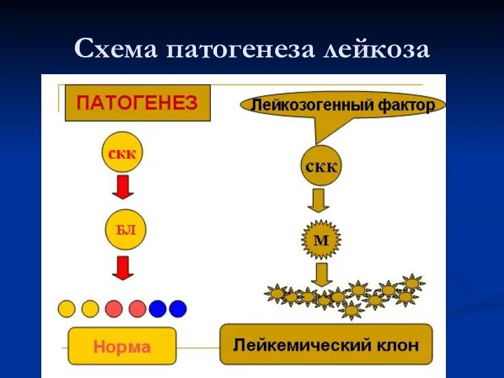 Схема патогенеза лейкоза