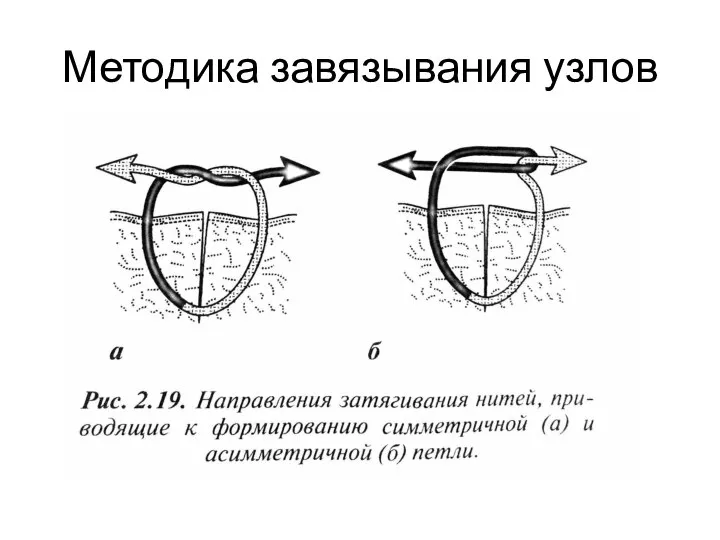 Методика завязывания узлов