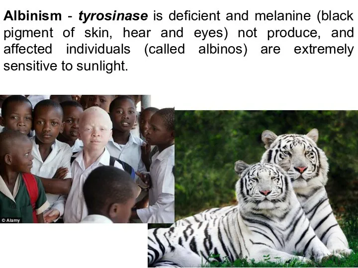 Albinism - tyrosinase is deficient and melanine (black pigment of skin, hear