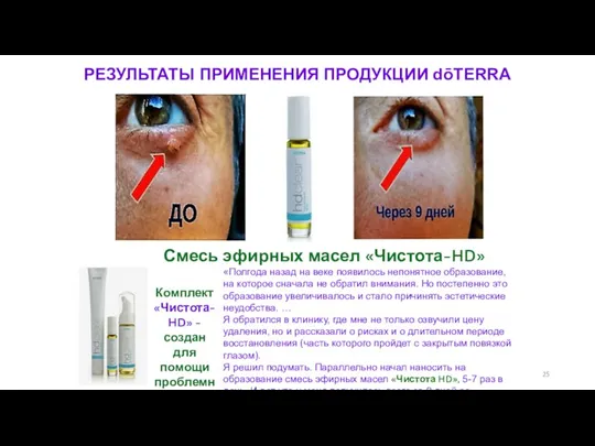 РЕЗУЛЬТАТЫ ПРИМЕНЕНИЯ ПРОДУКЦИИ dōTERRA Комплект «Чистота-HD» - создан для помощи проблемной коже