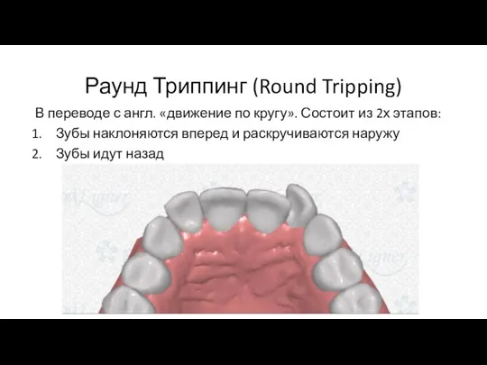 Раунд Триппинг (Round Tripping) В переводе с англ. «движение по кругу». Состоит