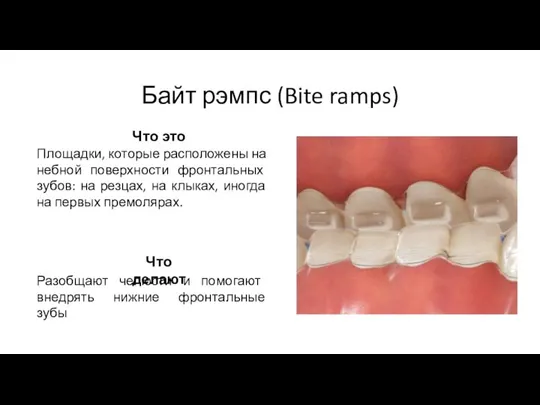 Байт рэмпс (Bite ramps) Площадки, которые расположены на небной поверхности фронтальных зубов: