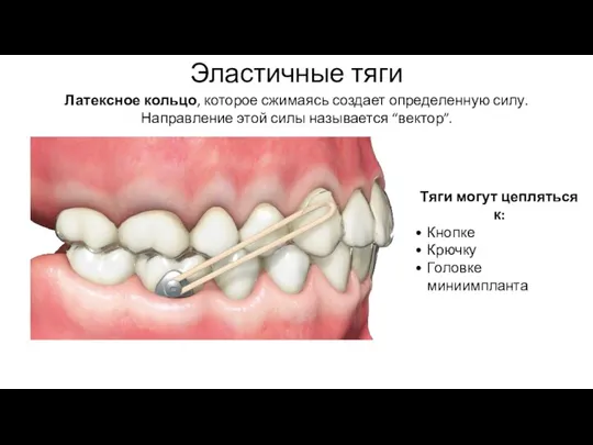 Эластичные тяги Латексное кольцо, которое сжимаясь создает определенную силу. Направление этой силы