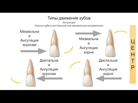 Типы движения зубов Ангуляция Наклон зуба в дистальном или мезиальном направлении Мезиальная