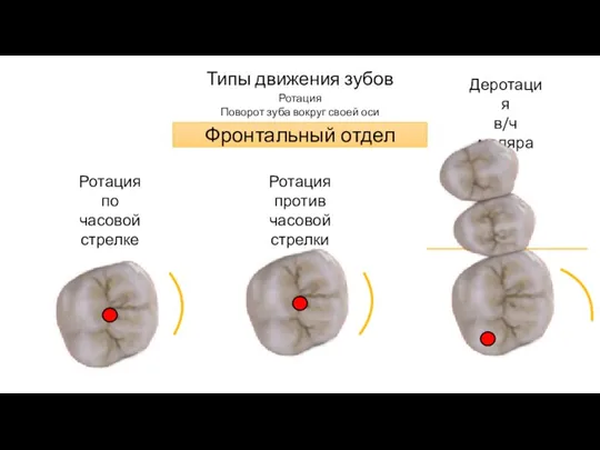 Типы движения зубов Ротация Поворот зуба вокруг своей оси Ротация по часовой