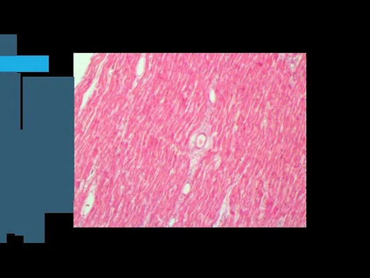 Окраска:гематоксилин и эозин Увеличение х50 Миокард.