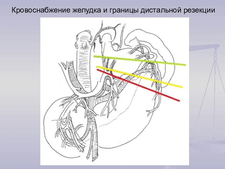 Кровоснабжение желудка и границы дистальной резекции