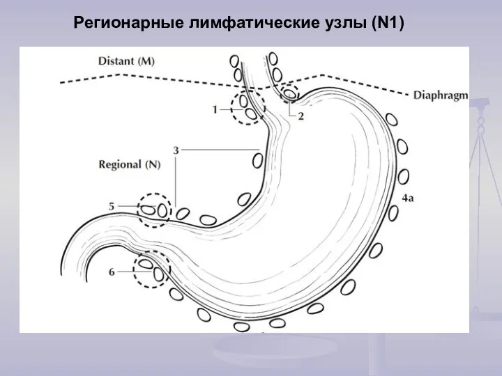 Регионарные лимфатические узлы (N1)