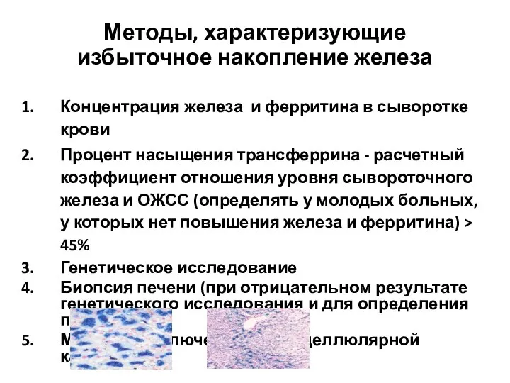 Методы, характеризующие избыточное накопление железа Концентрация железа и ферритина в сыворотке крови