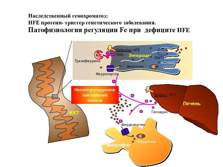 Наследственный гемохроматоз: HFE протеин- триггер генетического заболевания. Патофизиология регуляции Fe при дефиците