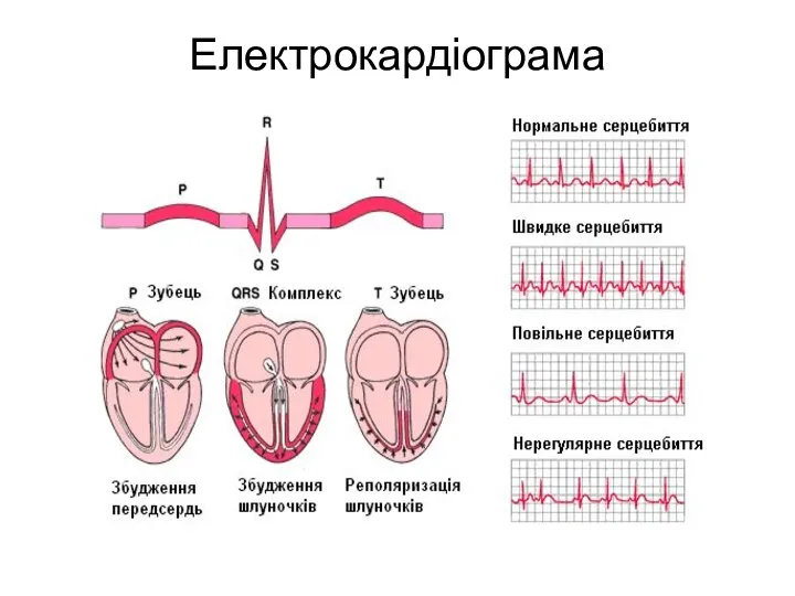 Електрокардіограма