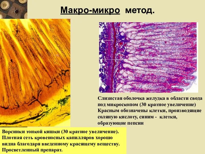 Слизистая оболочка желудка в области свода под микроскопом (30 кратное увеличение) Красным