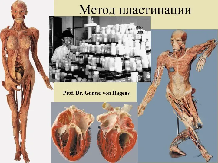 Метод пластинации Prof. Dr. Gunter von Hagens