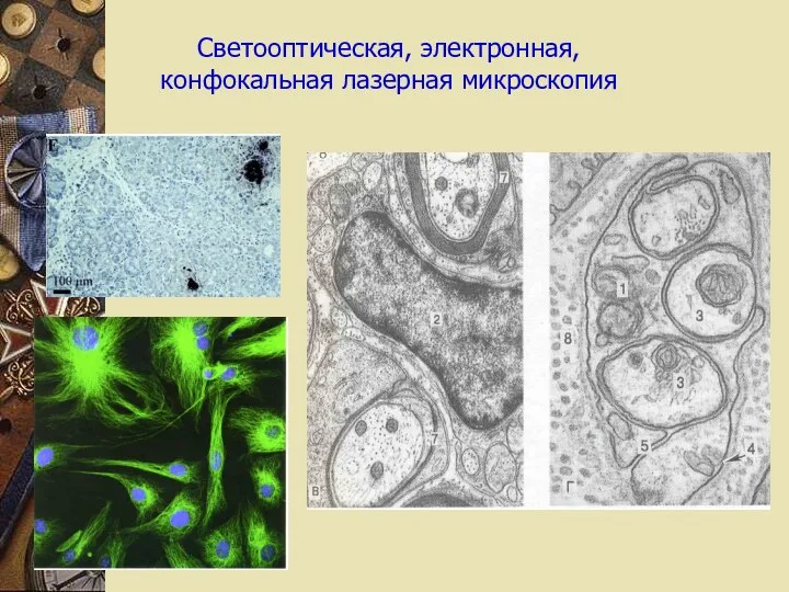 Светооптическая, электронная, конфокальная лазерная микроскопия