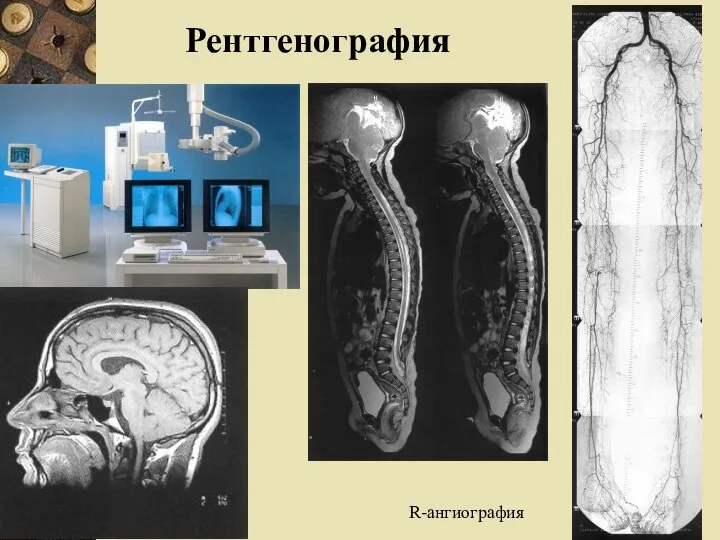 Рентгенография R-ангиография