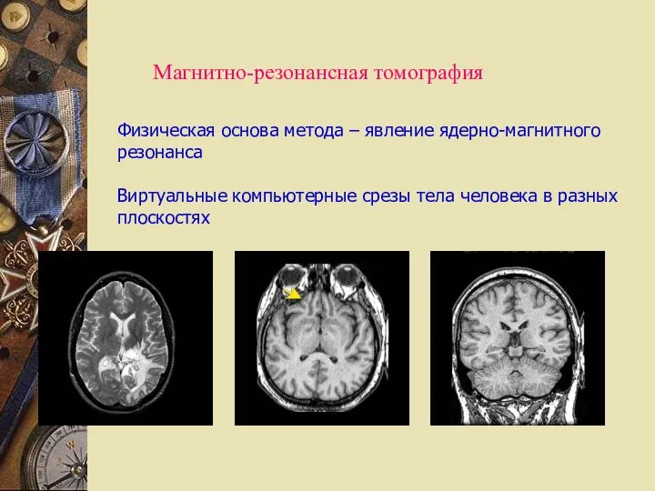 Магнитно-резонансная томография Физическая основа метода – явление ядерно-магнитного резонанса Виртуальные компьютерные срезы