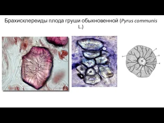 Брахисклереиды плода груши обыкновенной (Pyrus communis L.)