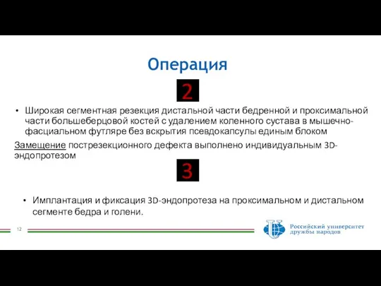 Операция Широкая сегментная резекция дистальной части бедренной и проксимальной части большеберцовой костей