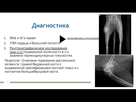 Диагностика ОКА и б/х крови УЗИ сердца и брюшной полости Рентгенографическое исследование