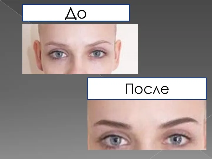 До После