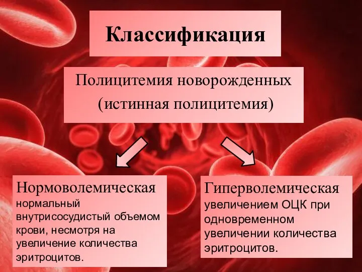 Классификация Полицитемия новорожденных (истинная полицитемия) Нормоволемическая нормальный внутрисосудистый объемом крови, несмотря на