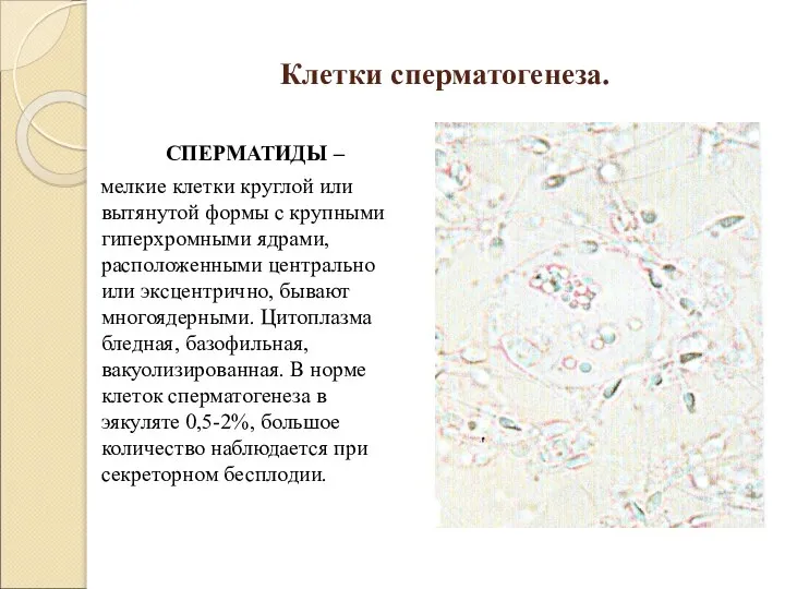 Клетки сперматогенеза. СПЕРМАТИДЫ – мелкие клетки круглой или вытянутой формы с крупными