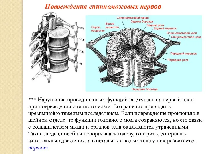 Повреждения спинномозговых нервов *** Нарушение проводниковых функций выступает на первый план при