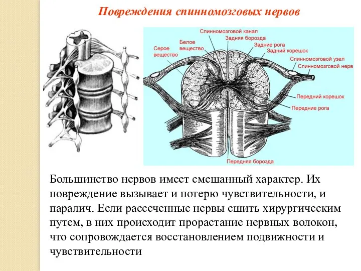 Повреждения спинномозговых нервов Большинство нервов имеет смешанный характер. Их повреждение вызывает и