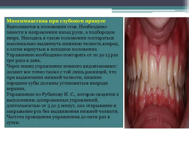 Миогимнастика при глубоком прикусе Выполняется в положении стоя. Необходимо занести в направлении