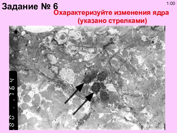 Охарактеризуйте изменения ядра (указано стрелками) Задание № 6 1:00