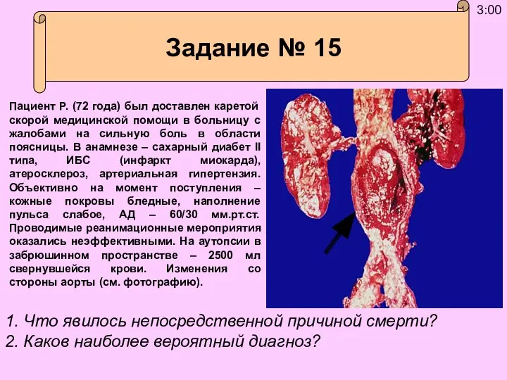 Пациент Р. (72 года) был доставлен каретой скорой медицинской помощи в больницу