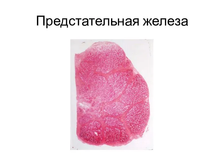 Предстательная железа