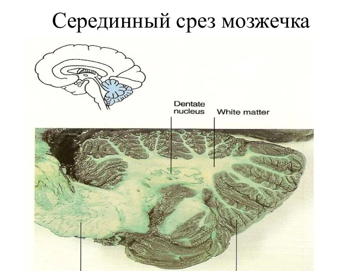 Серединный срез мозжечка