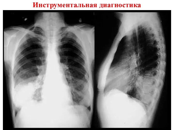 Инструментальная диагностика