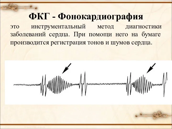 ФКГ - Фонокардиография это инструментальный метод диагностики заболеваний сердца. При помощи него