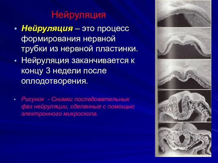 Нейруляция Нейруляция – это процесс формирования нервной трубки из нервной пластинки. Нейруляция