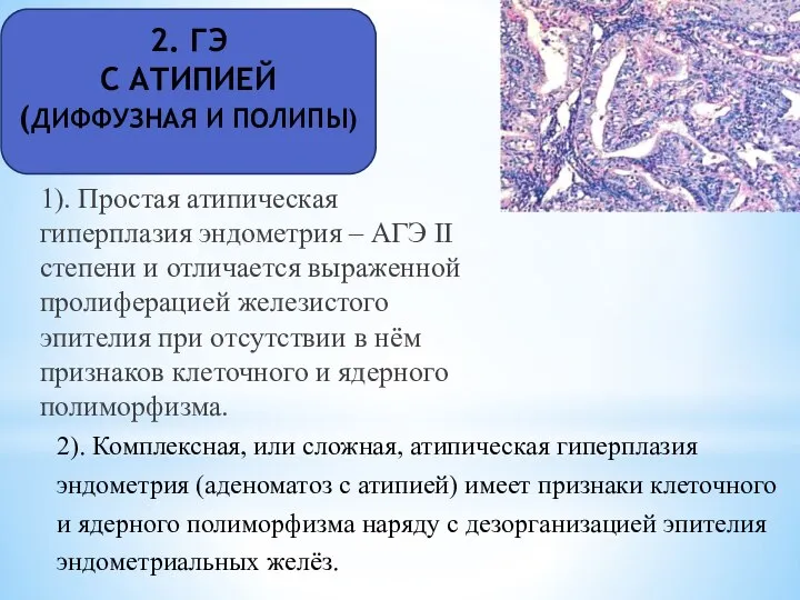 2. ГЭ С АТИПИЕЙ (ДИФФУЗНАЯ И ПОЛИПЫ) 1). Простая атипическая гиперплазия эндометрия
