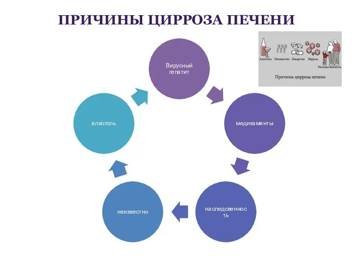 ПРИЧИНЫ ЦИРРОЗА ПЕЧЕНИ