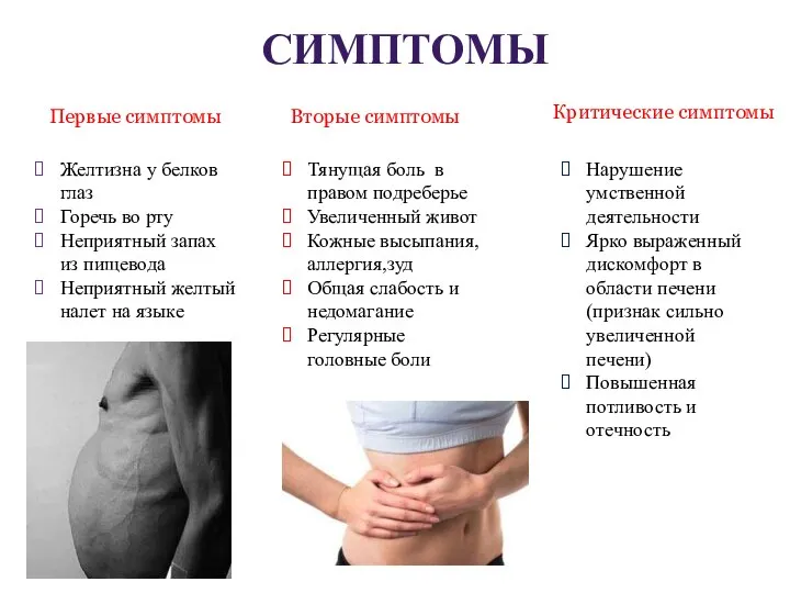 СИМПТОМЫ Желтизна у белков глаз Горечь во рту Неприятный запах из пищевода