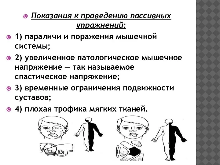 Показания к проведению пассивных упражнений: 1) параличи и поражения мышечной системы; 2)