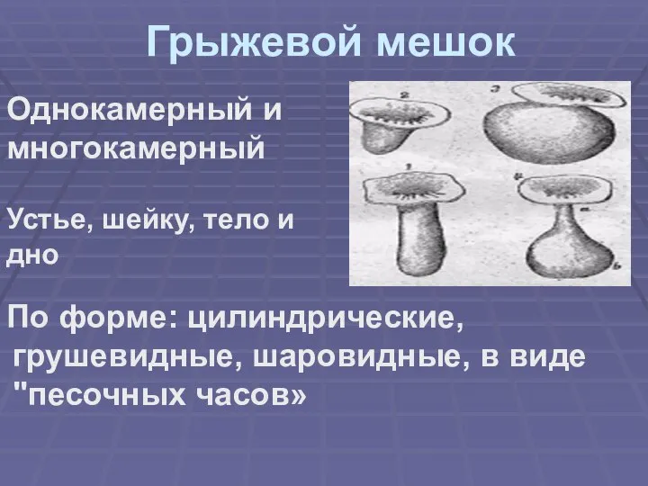 Грыжевой мешок По форме: цилиндрические, грушевидные, шаровидные, в виде "песочных часов» Однокамерный