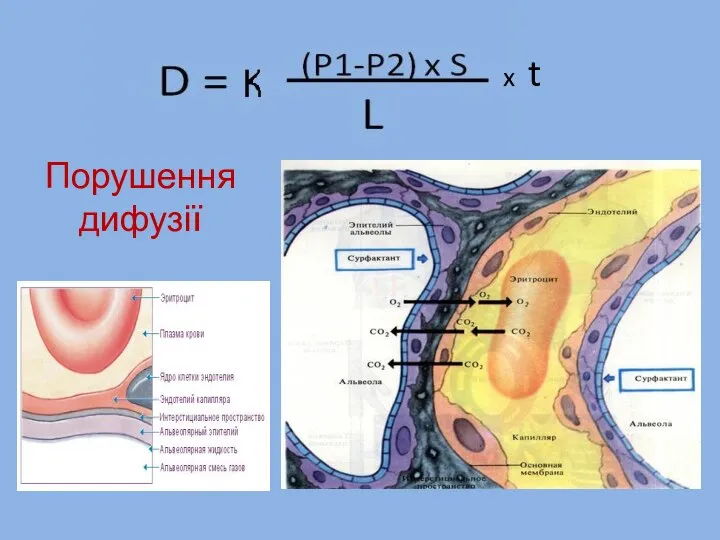 Порушення дифузії