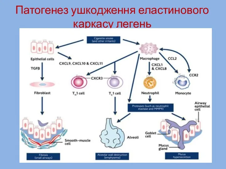 Патогенез ушкодження еластинового каркасу легень