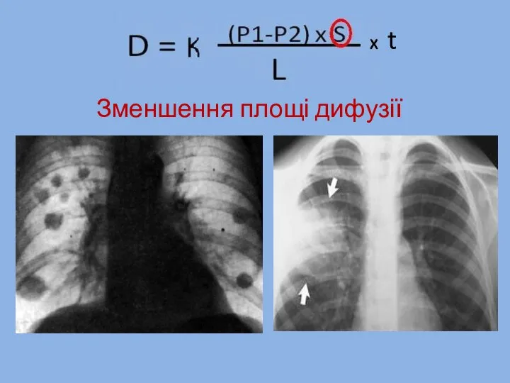 Зменшення площі дифузії