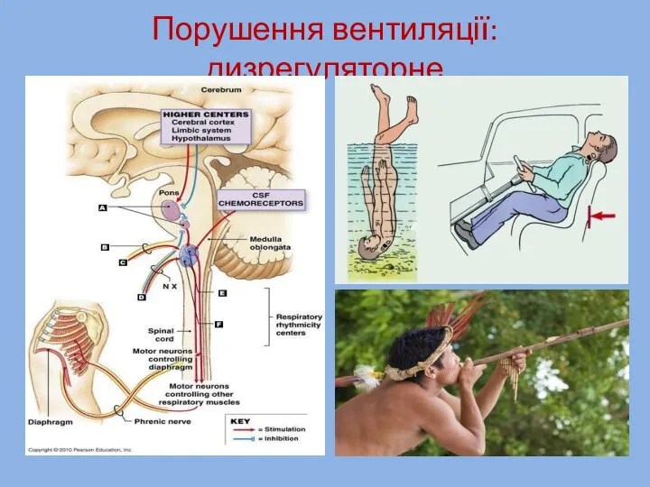 Порушення вентиляції: дизрегуляторне