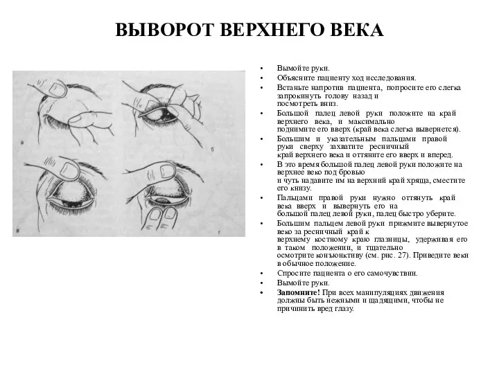 ВЫВОРОТ ВЕРХНЕГО ВЕКА Вымойте руки. Объясните пациенту ход исследования. Встаньте напротив пациента,