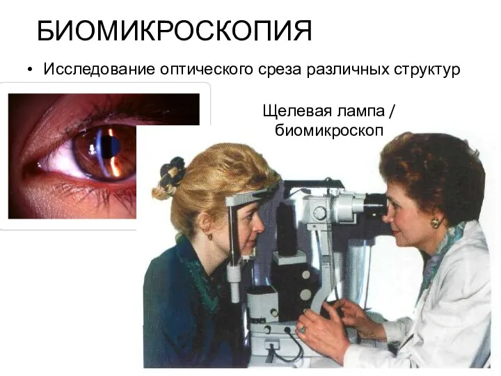 БИОМИКРОСКОПИЯ Исследование оптического среза различных структур глаза Щелевая лампа / биомикроскоп