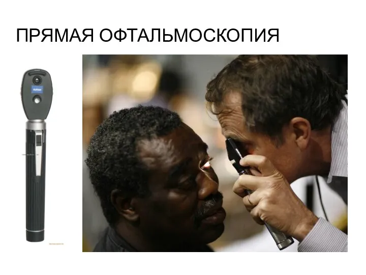 ПРЯМАЯ ОФТАЛЬМОСКОПИЯ