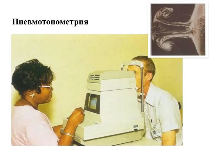 Пневмотонометрия