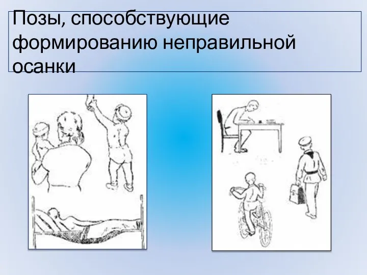 Позы, способствующие формированию неправильной осанки